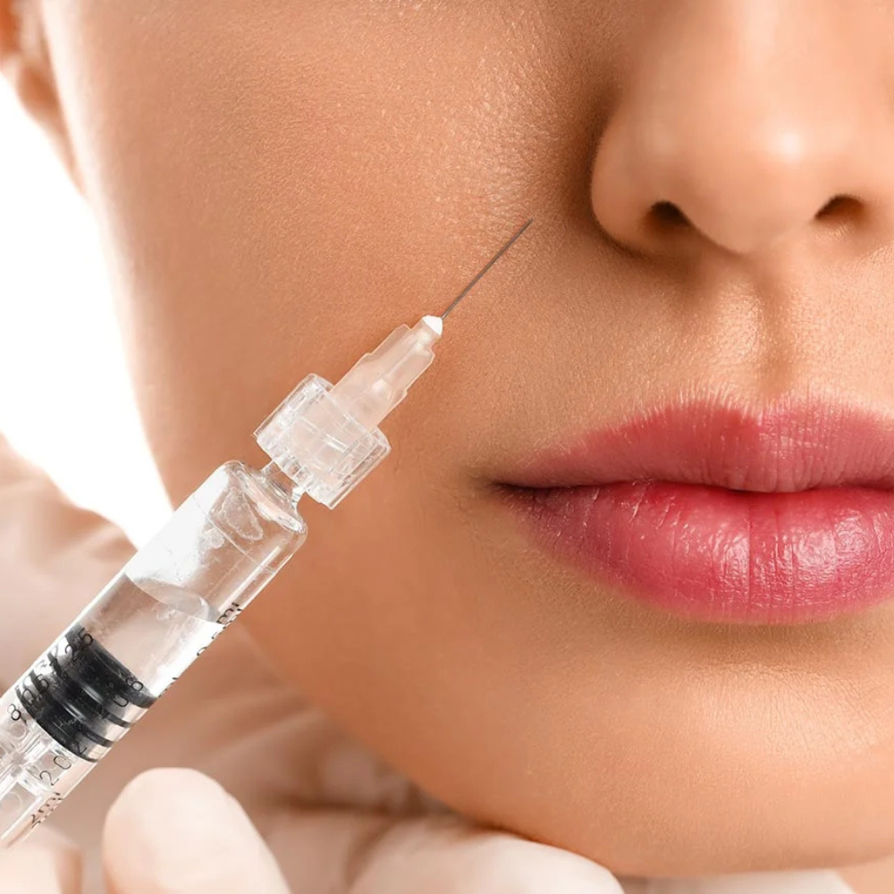 Injection d’acide hyaluronique dans la joue d’une femme